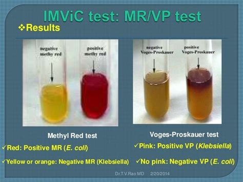 purpose of mr vp test.